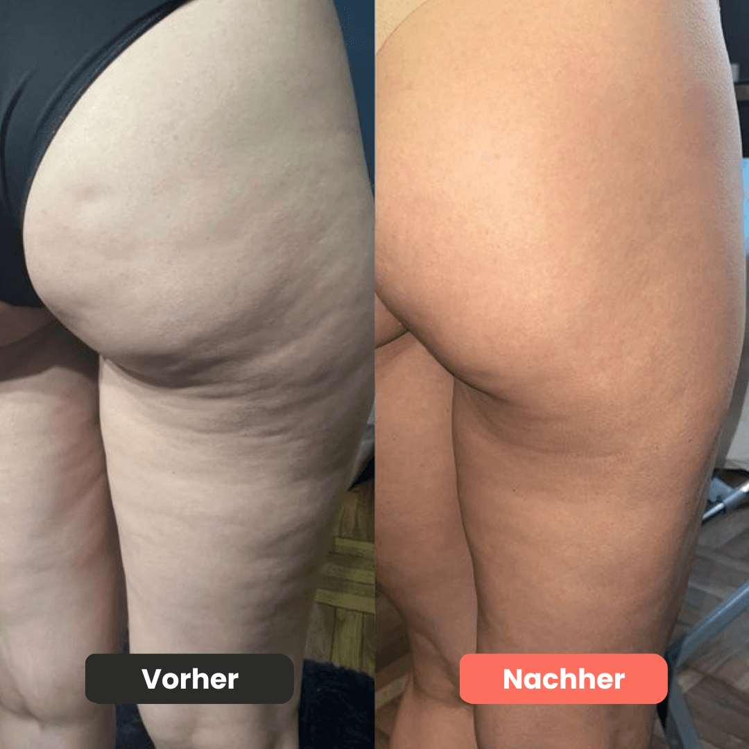 Cellugone 3.0 - Sichtbar glattere & straffere Haut