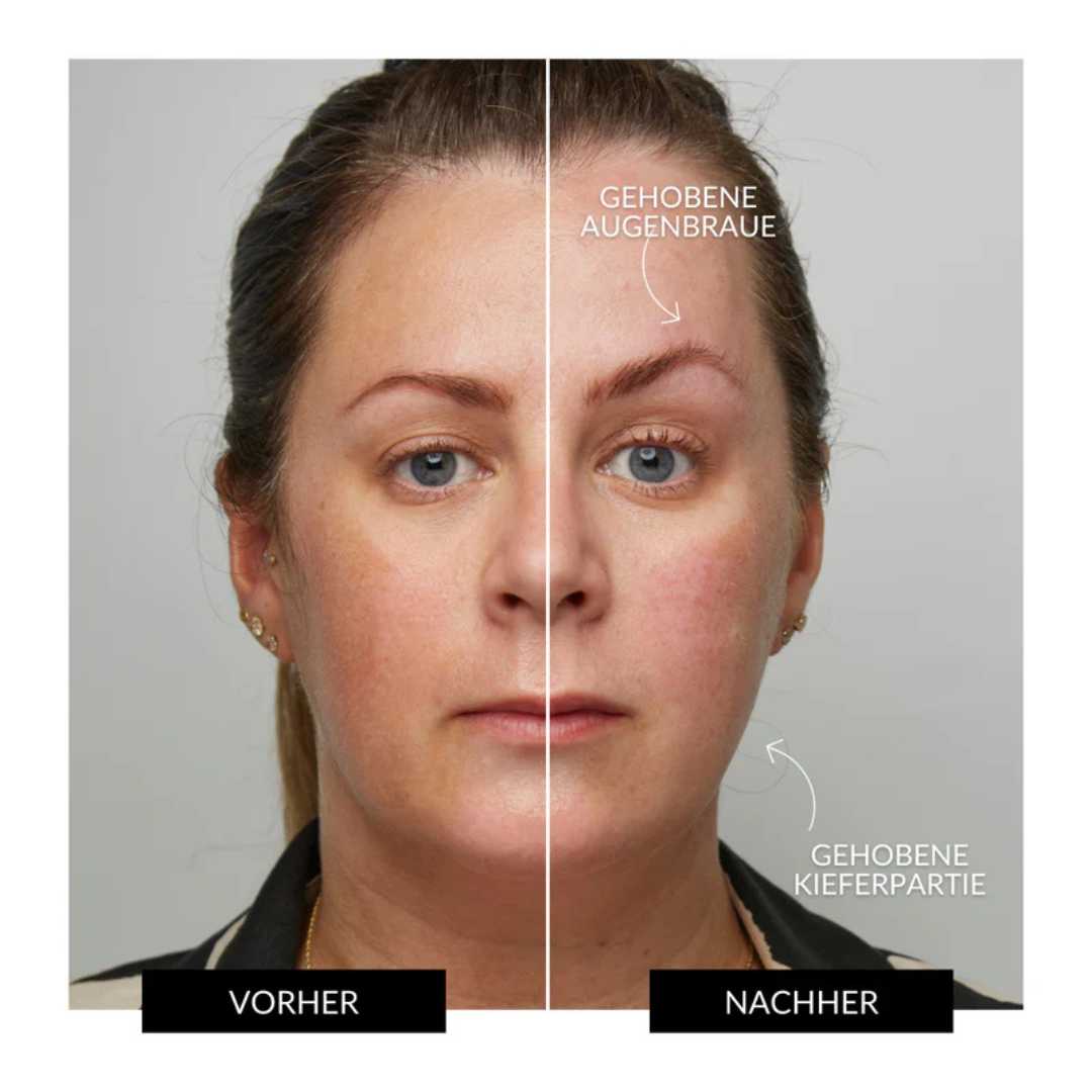 Face io - Glätten, Straffen, Reinigen:  für strahlende Haut