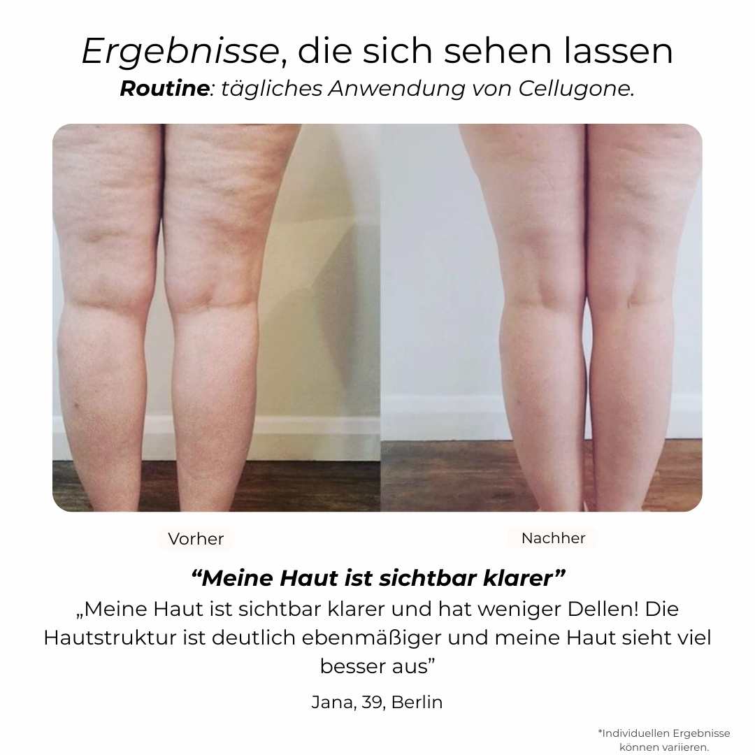 Cellugone 3.0 - Sichtbar glattere & straffere Haut