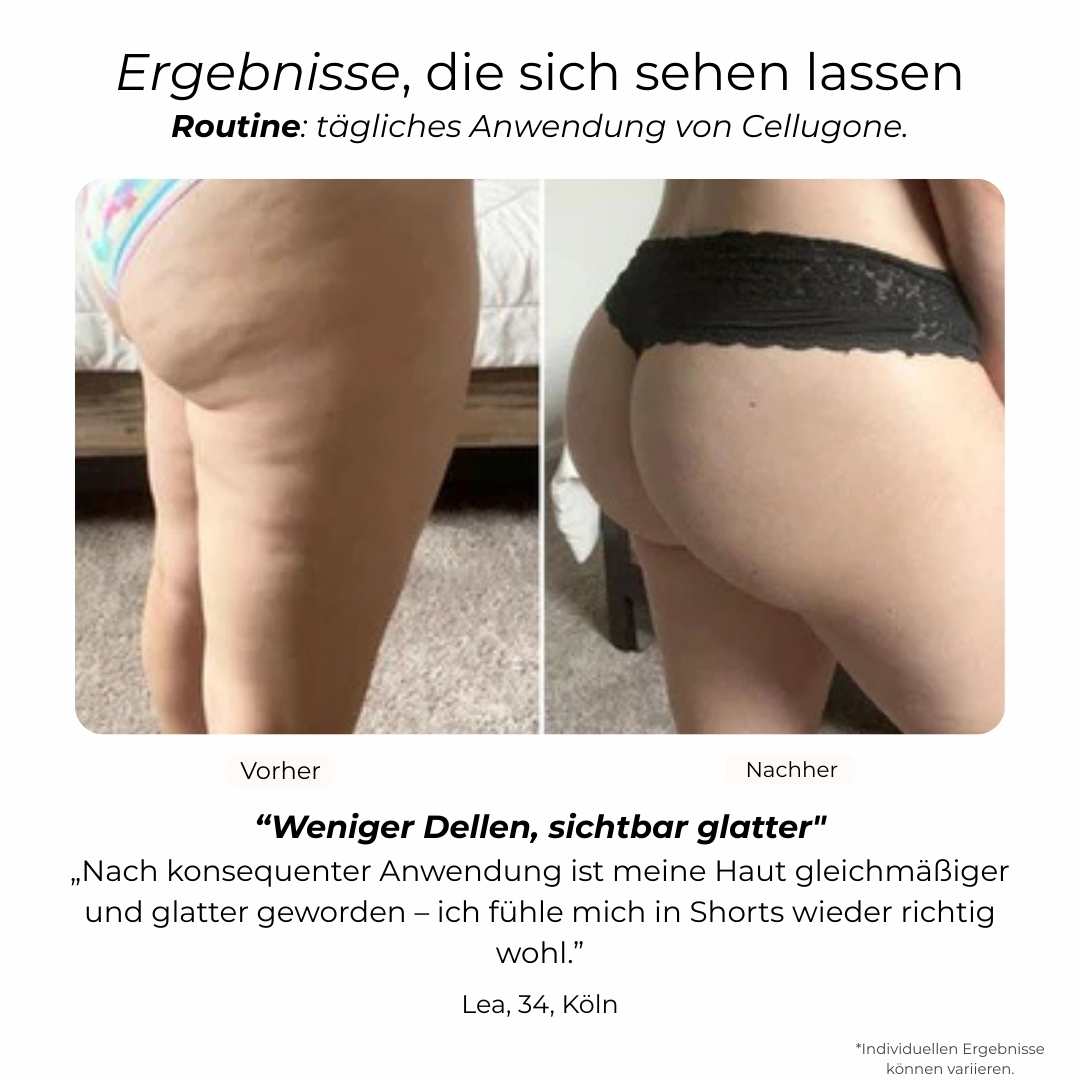 Cellugone 3.0 - Sichtbar glattere & straffere Haut