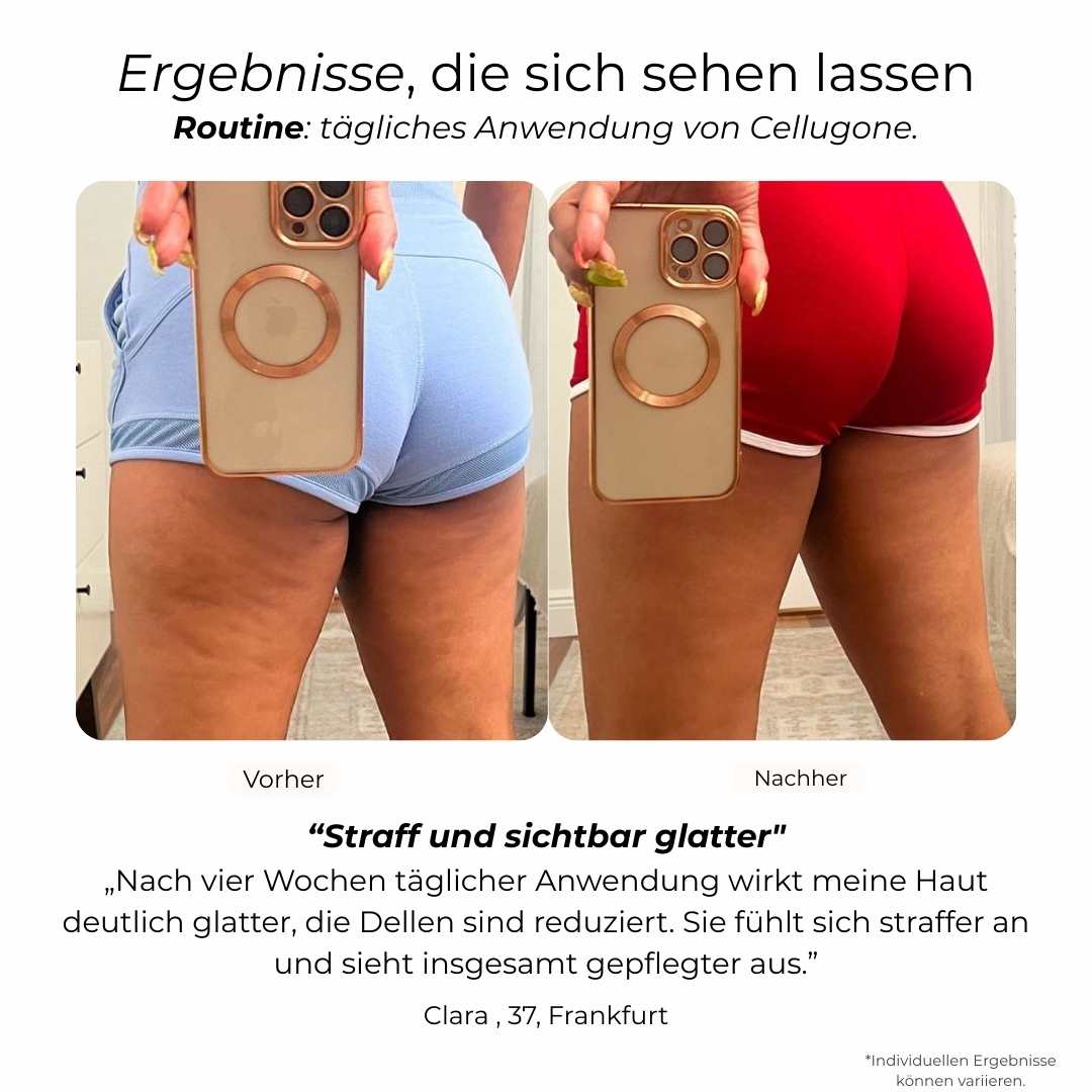 Cellugone 3.0 - Sichtbar glattere & straffere Haut