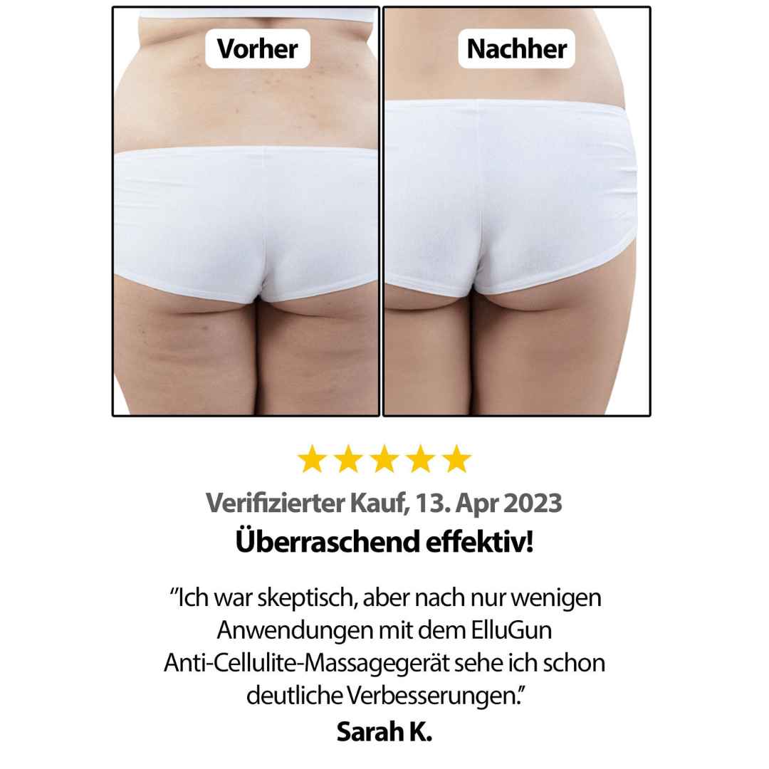 Cellugone 2.0 - INFRAROT MASSAGE Gerät
